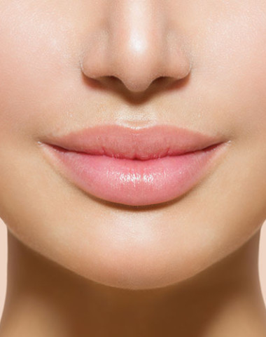 Lips Fillers & Augmentation In Edmonton