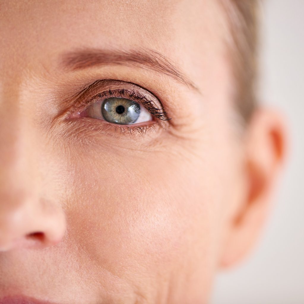 Under Eye Bags & Dark Circles | Rao Dermatology